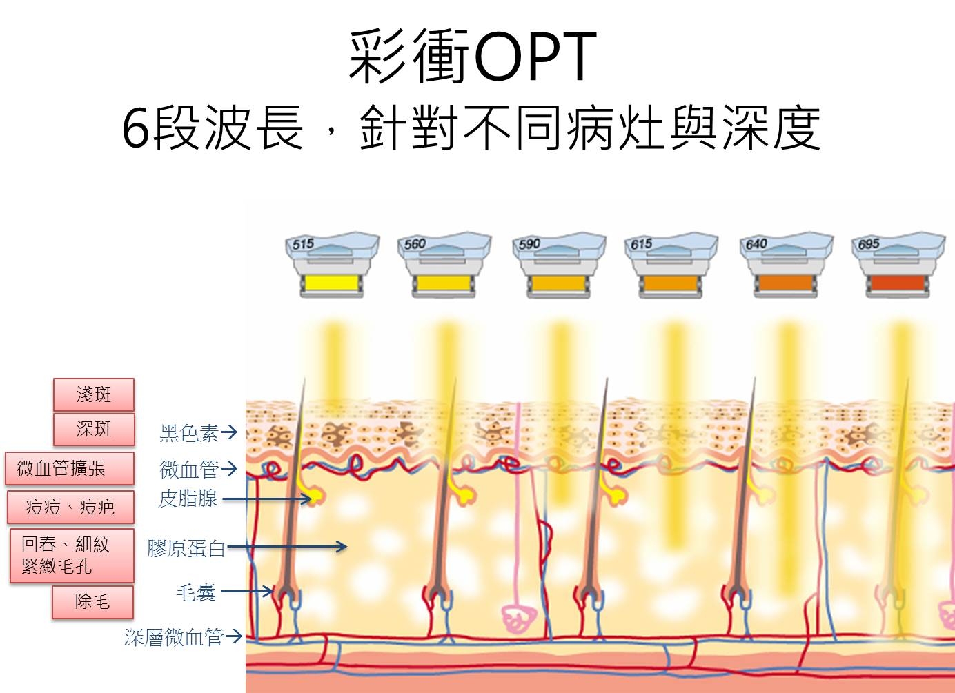 m22光梭雷射 M22 OPT Resurf