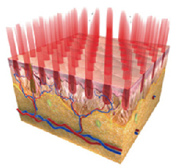 M22光梭雷射 M22光梭雷射