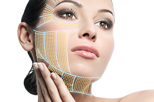 ULTHERA極線超音波拉皮術後護理及注意事項