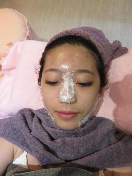 【素人分享】搶救鼻子大作戰– 看醫美小叮噹 黃雍宗醫師 如何解決小護士的煩惱!!!!! 【素人分享】搶救鼻子大作戰– 看醫美小叮噹 黃雍宗醫師 如何解決小護士的煩惱!!!!!