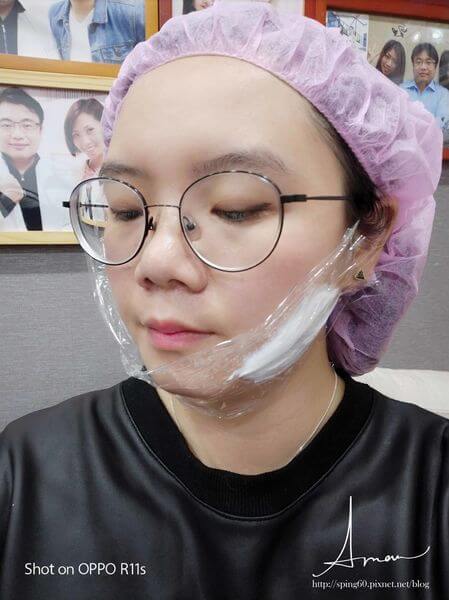 【素人分享】南港杏安診所醫美-肉毒桿菌素瘦小臉~ 【素人分享】南港杏安診所醫美-肉毒桿菌素瘦小臉~