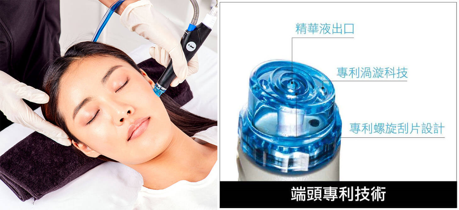 南港 HydraFacial海菲秀推薦 改善臉頰粉刺、痘痘