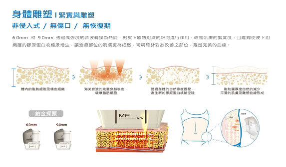 第三代海芙音波音波拉提(Ultraformer III )