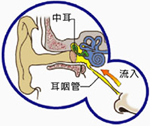 急性中耳炎-衛教專欄-杏安診所