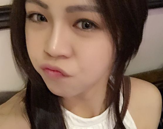 玻尿酸隆鼻-下巴-鼻樑-塌鼻子-舒顏萃-肌膚水分-光澤