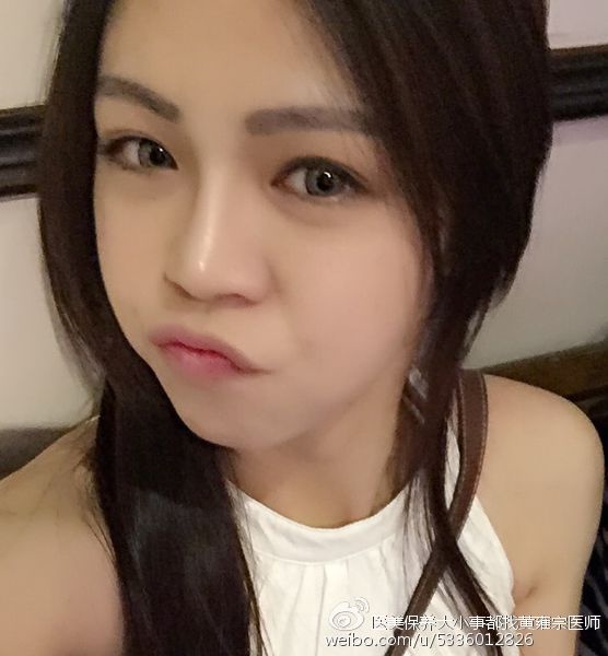 玻尿酸隆鼻-下巴-鼻樑-塌鼻子-舒顏萃-肌膚水分-光澤