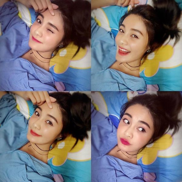 台北-自體脂肪-隆乳-抽脂-失敗-玻尿酸-拯救淚溝-玻尿酸失敗-整形失敗-失敗補救-微整形-自體脂肪填補-硬化-後遺症-推薦-價格