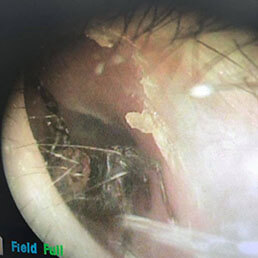 【耳裡的盤絲洞】