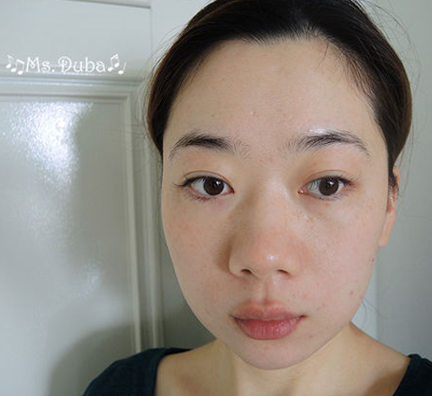 淨柔膚雷射, M22光梭雷射, 毛孔變小, 皮膚變亮～醫美初體驗！