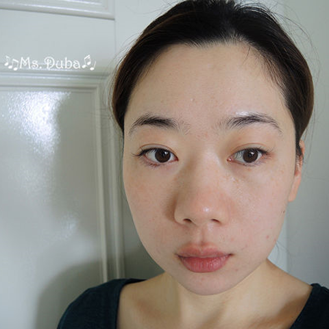 淨柔膚雷射, M22光梭雷射, 毛孔變小, 皮膚變亮~醫美初體驗!