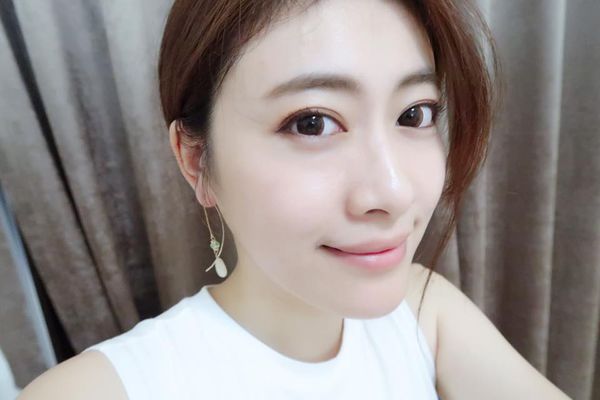 杏安 醫美 黃雍宗 自然 玻尿酸 肉毒桿菌 瘦小臉 整形 微整 尖下巴 混血兒 立體 山根 媽媽 玻尿酸下巴 肉毒小臉 多點式拉提打法 安全 推薦 明星