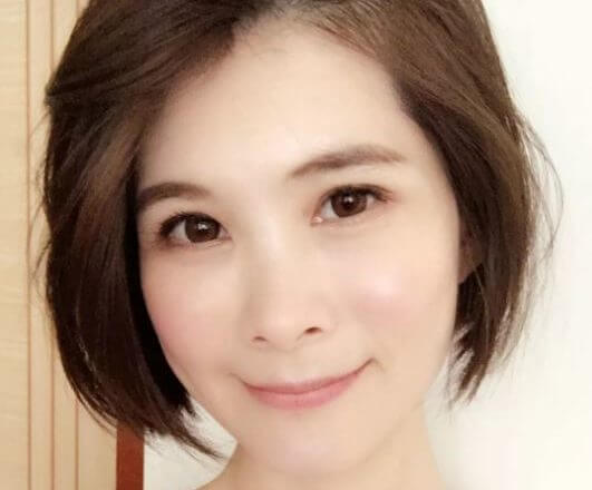 素人分享-擺脫苦命臉~豐頰甩凹臉找黃雍宗醫師就對了(杏安診所)