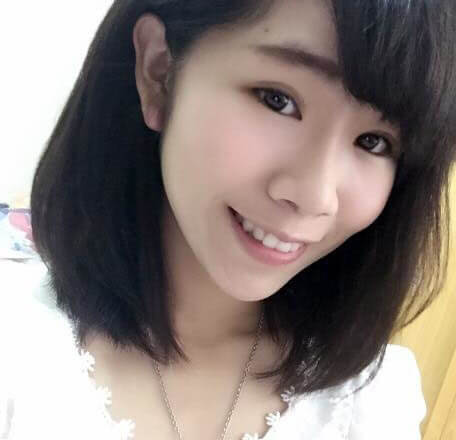 (素人分享) 玻尿酸給我自然山根&下巴之60天日記