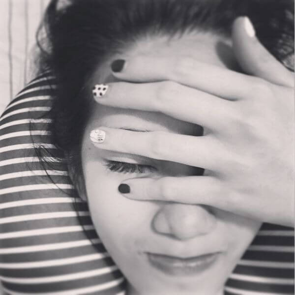 【素人分享】搶救鼻子大作戰– 看醫美小叮噹 黃雍宗醫師 如何解決小護士的煩惱!!!!!