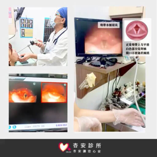 聲帶發炎 原來是 這樣~~
