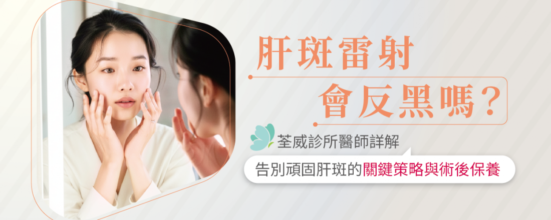 肝斑雷射會反黑嗎？荃威診所醫師詳解：告別頑固肝斑的關鍵策略與術後保養