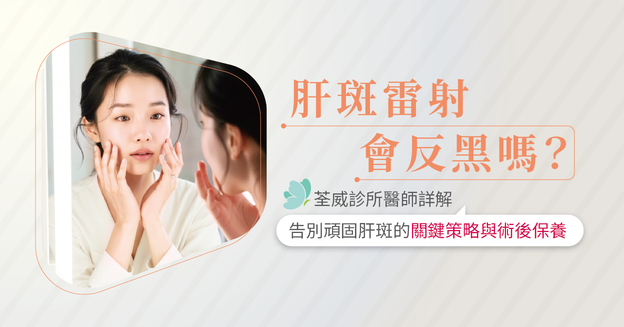 肝斑雷射會反黑嗎?荃威診所醫師詳解:告別頑固肝斑的關鍵策略與術後保養